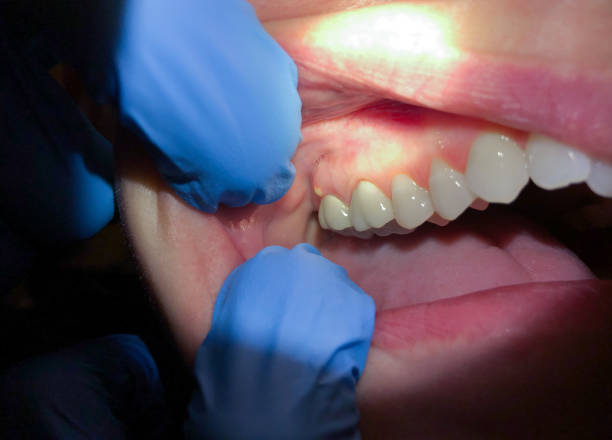 Best Emergency Orthodontic Repairs in Ellinwood, KS