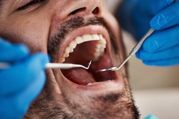 Best Urgent Dental Care for Toothaches in Ellinwood, KS